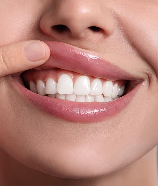 Smiling woman with a finger covering her mouth, showcasing a bright smile and shiny teeth.