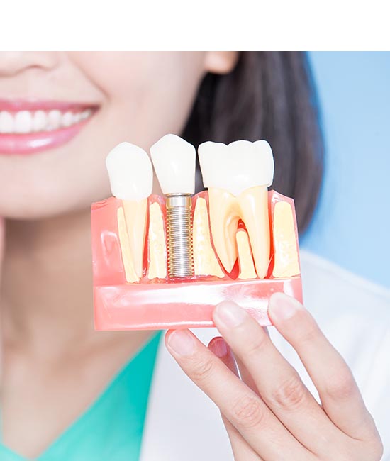 The image shows a person holding a dental model with various teeth structures and an implant screwed into the jawbone, likely demonstrating dental implant technology.
