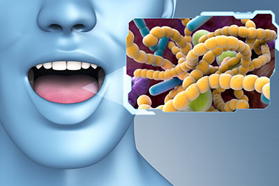 An image with a 3D rendering of a person s face, a close-up of a mouth, and an overlay graphic of microscopic bacteria or viruses against a blue background.