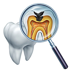 The image shows a magnified view of a tooth with its root structure, including the pulp chamber and the surrounding bone, displayed under a microscope.