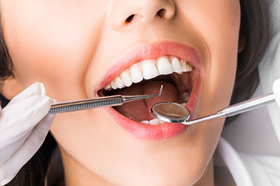 A woman with a wide smile is shown in close-up, with her teeth being examined by a dentist using dental instruments.