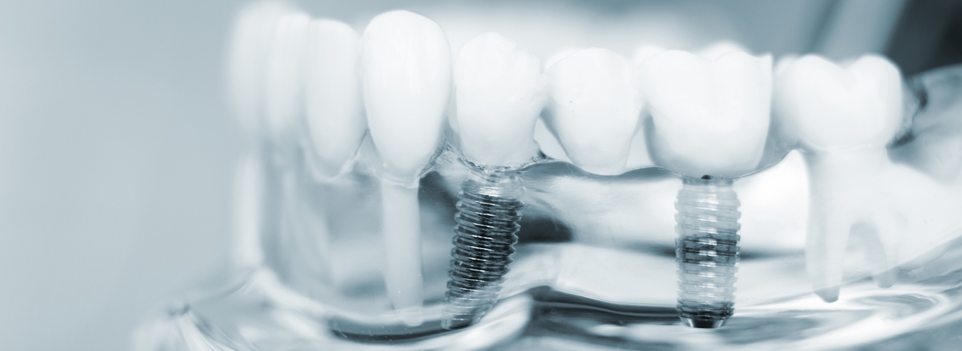 The image shows a close-up of several teeth with visible enamel and gumline, placed against a blurred background that appears to be a transparent material or substance.