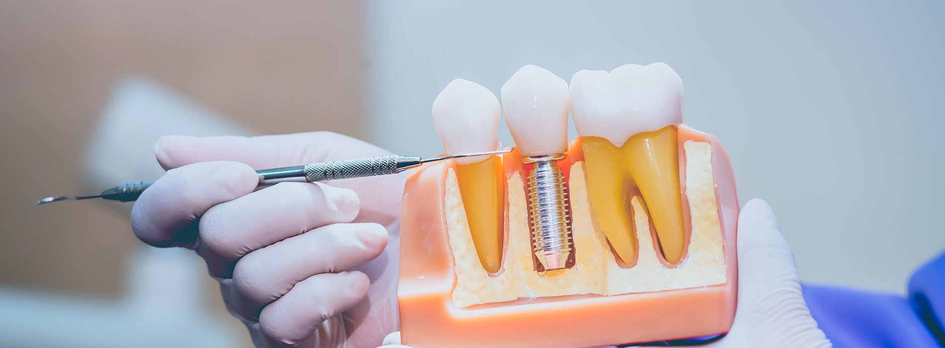 A person is holding a dental implant tool with teeth in a tray, examining it closely.