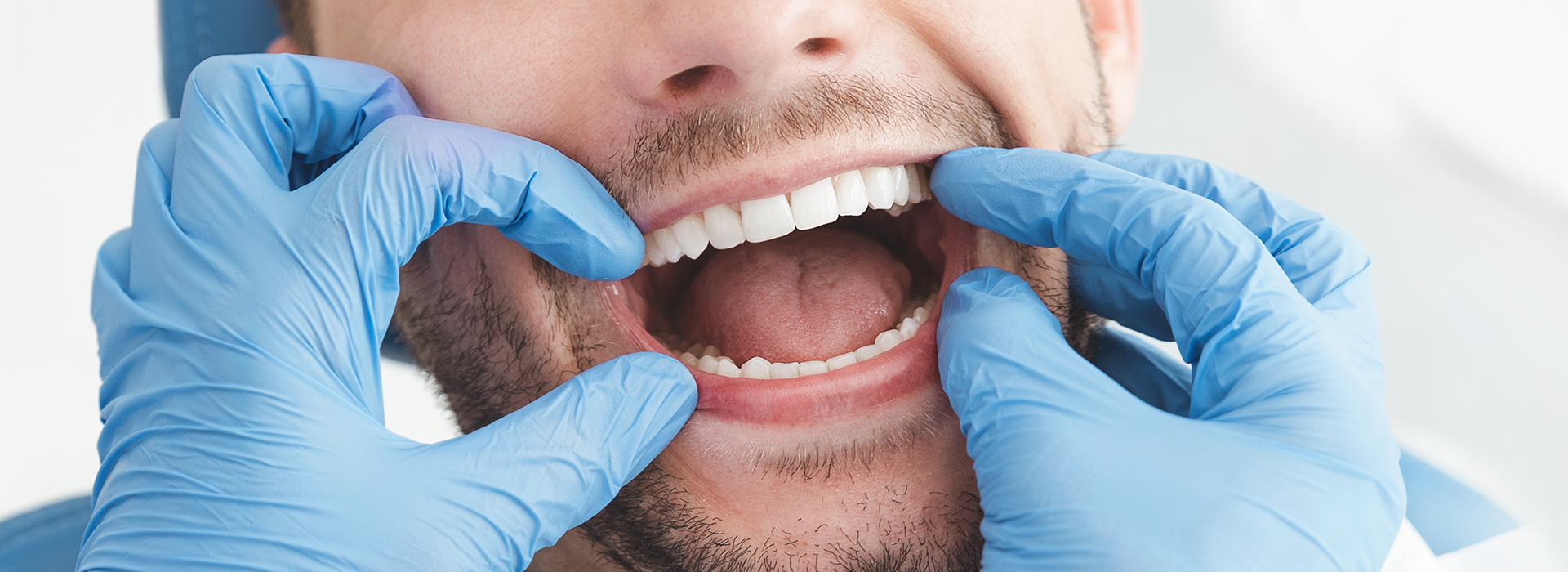 The image shows a man with his mouth open, wearing blue gloves and a surgical mask, likely in a dental or medical setting.