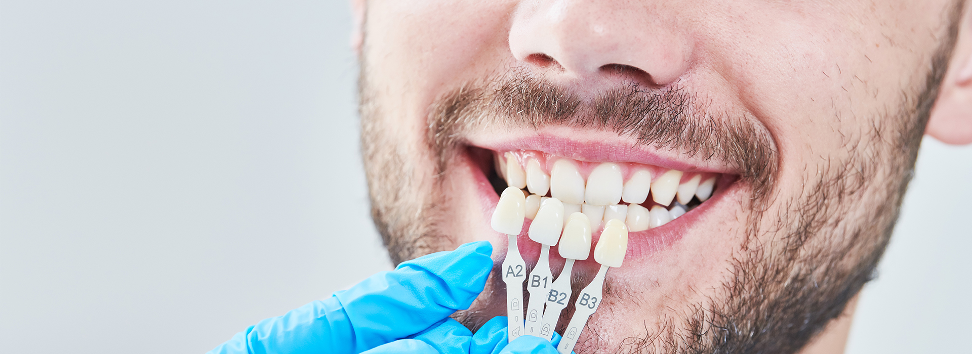 A man with a toothy smile is shown in close-up, wearing blue surgical gloves and holding dental implants.